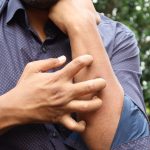 Studio Novartis, l’orticaria cronica spontanea costa 4.200 euro l’anno a paziente